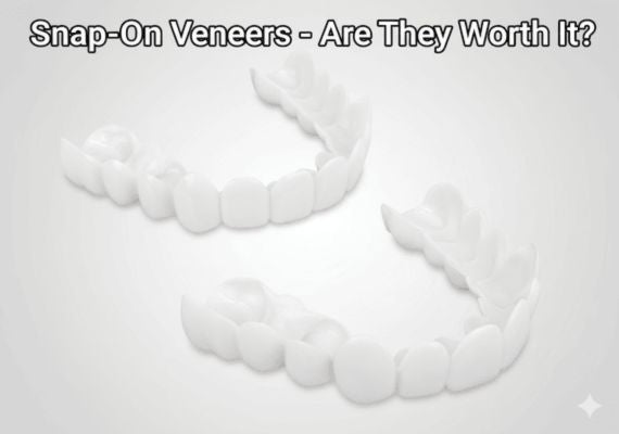 Snap-on veneers – Are they worth it?