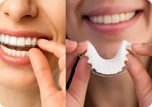 What’s the difference between white and clear retainers?