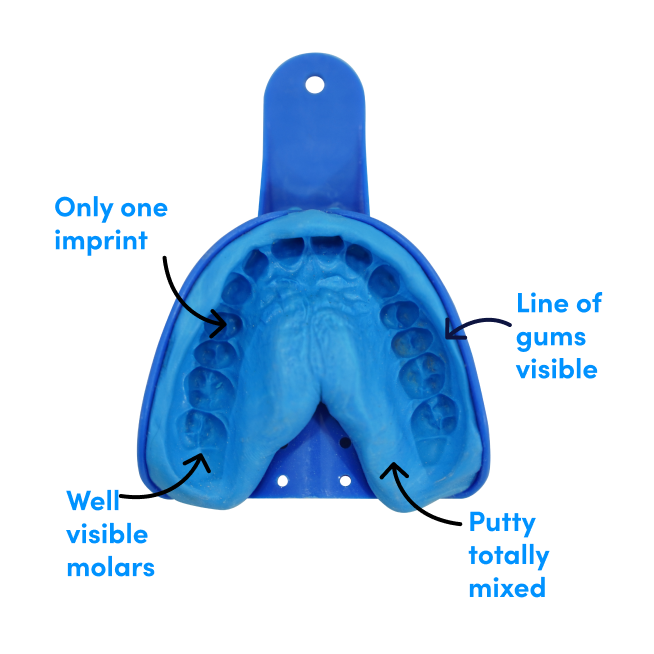 How to create precise dental impressions?