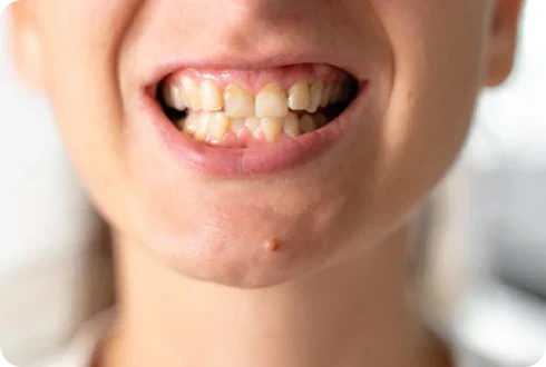 What to expect with a midline shift treatment