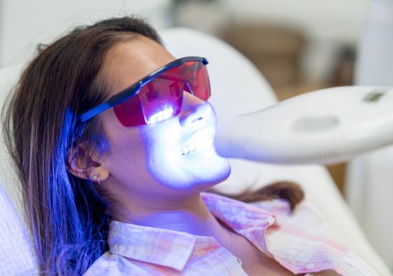 A woman getting laser teeth whitening treatment