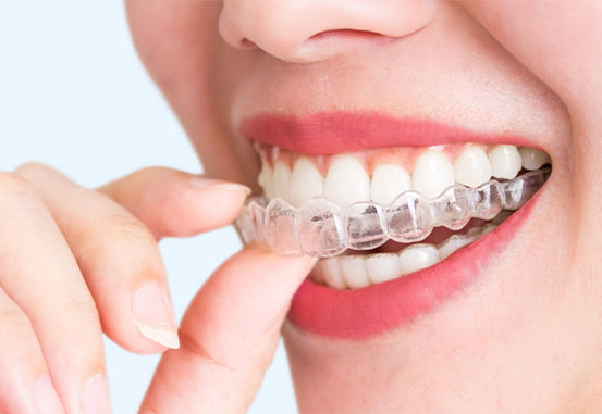 A girl applying retainers after braces.