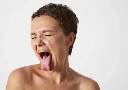 woman showing her burnt tongue.