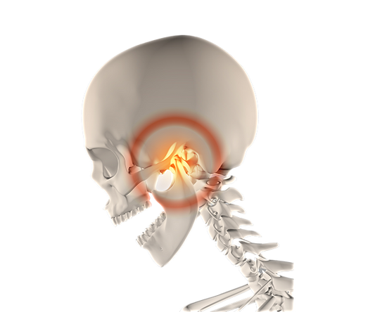 An image of a skeleton with a highlighted dislocated TMJ joint