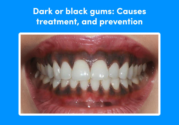 A close-up showing black gums.