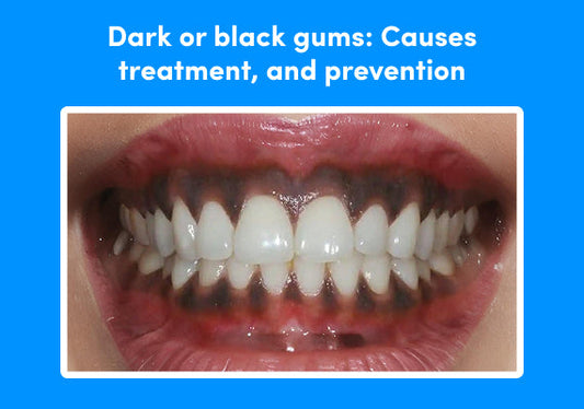 A close-up showing black gums.