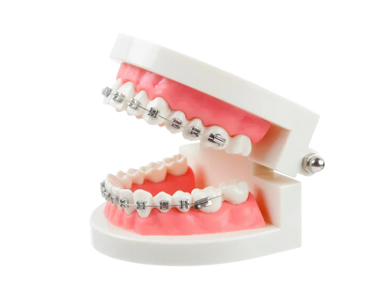 Clear braces for adults: What you need to know