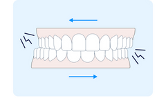 Is Bruxism More Common at Night?