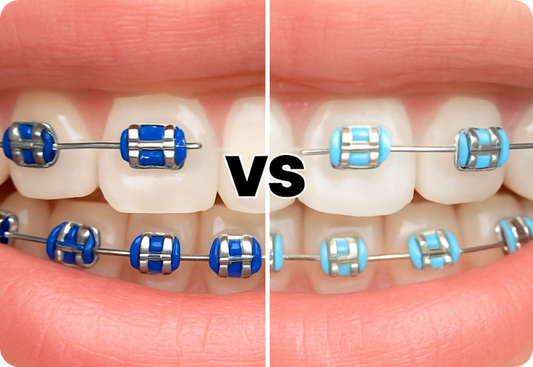Light blue vs. dark blue braces: What’s best for you?