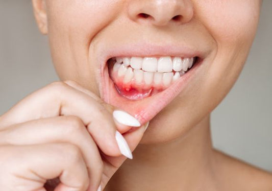 A girl having gum inflammation