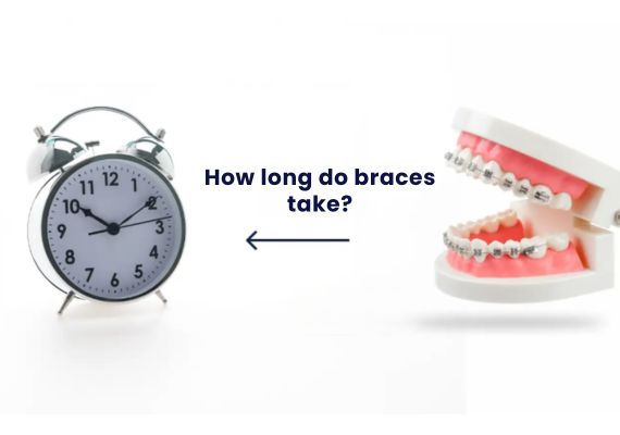 A clock and a dental model with braces on it on a white background