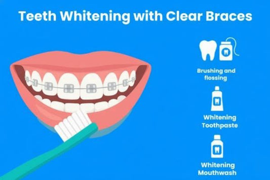 Teeth Whitening with braces