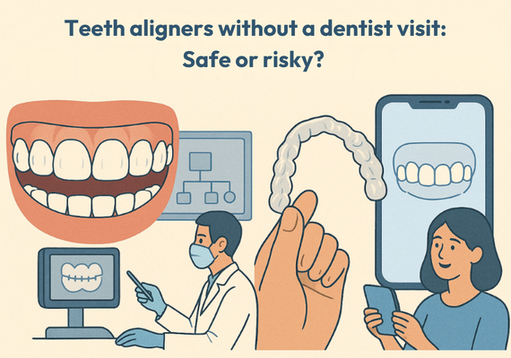 Teeth aligners without a dentist visit: Is it safe?