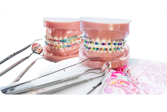 Braces colors: How to choose the best one for your smile