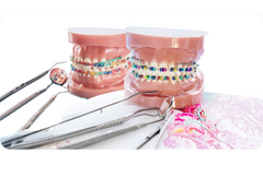 Braces colors: How to choose the best one for your smile