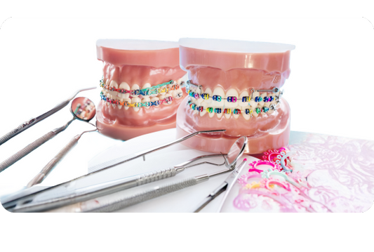 Braces colors: How to choose the best one for your smile