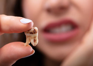 Dead tooth: Common signs and what to do next – Caspersmile