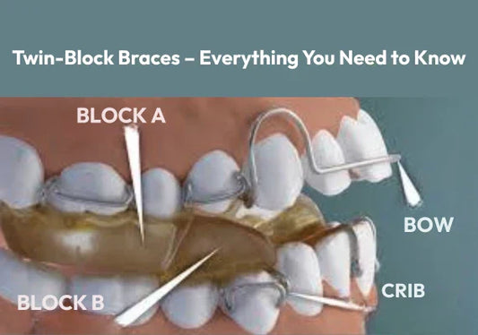 Twin-Block Braces – Everything You Need to Know