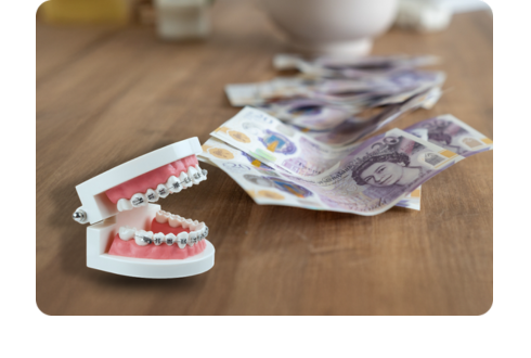 Are braces free in the UK? NHS vs. Private treatment explained