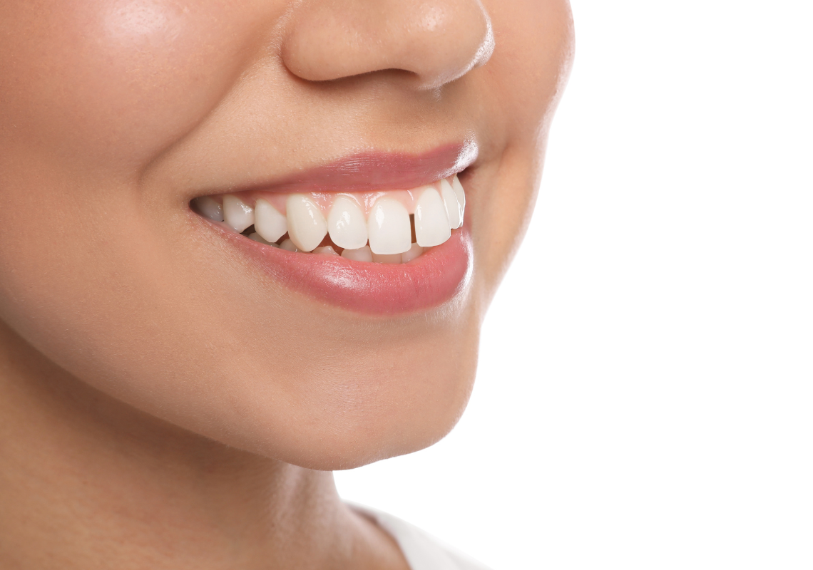  A young woman with a tooth gap relapse.