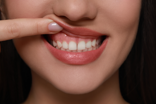 A young woman with healthy gums during aligner treatment