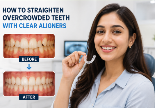 A smiling girl holding clear aligners with before-and-after results of overcrowded teeth on the side.