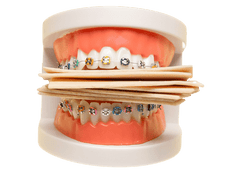 Can you chew gum with braces?