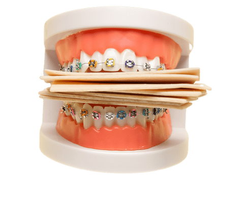 Can you chew gum with braces?