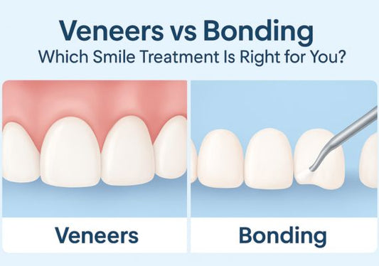 An image shows an illustration of veneers on one side and teeth bonding on the other side.