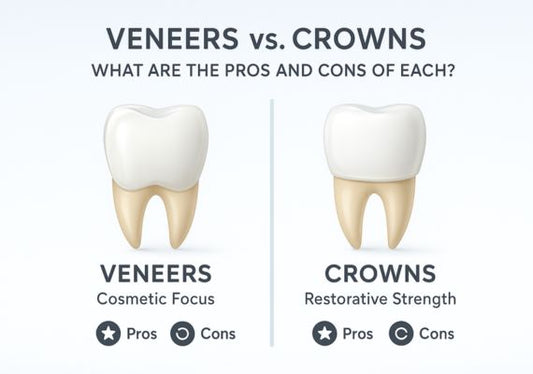 An image showing crowns and veneers side by side