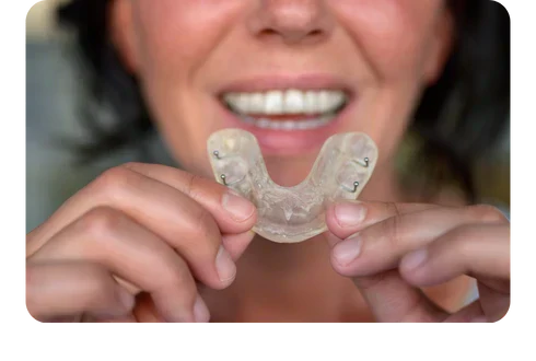 Top signs you need a mouth guard for clenching