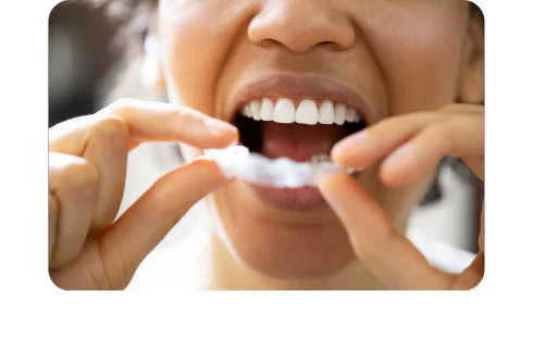 Can a mouth guard fix your bruxism permanently?