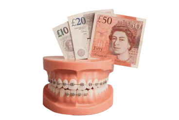 The complete guide to braces cost in the UK (2025 update)