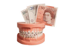 The complete guide to braces cost in the UK (2025 update)