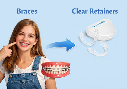 From braces to retainers, overbite journey.