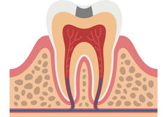 Pulpotomy: Uses, side effects, and procedure