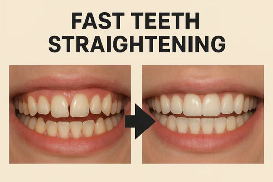 Before and after teeth straightening