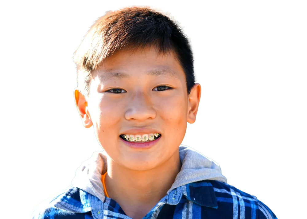 How much do braces cost in the UK for under-18s?