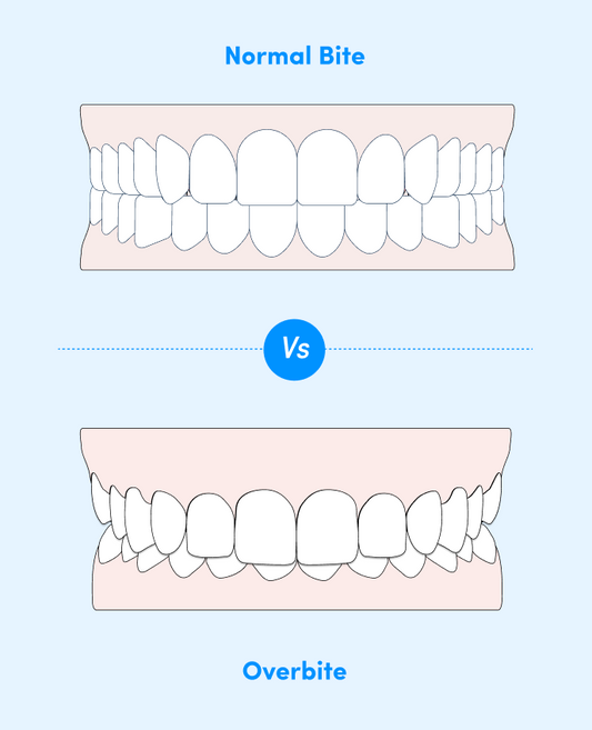 Featured Image 1