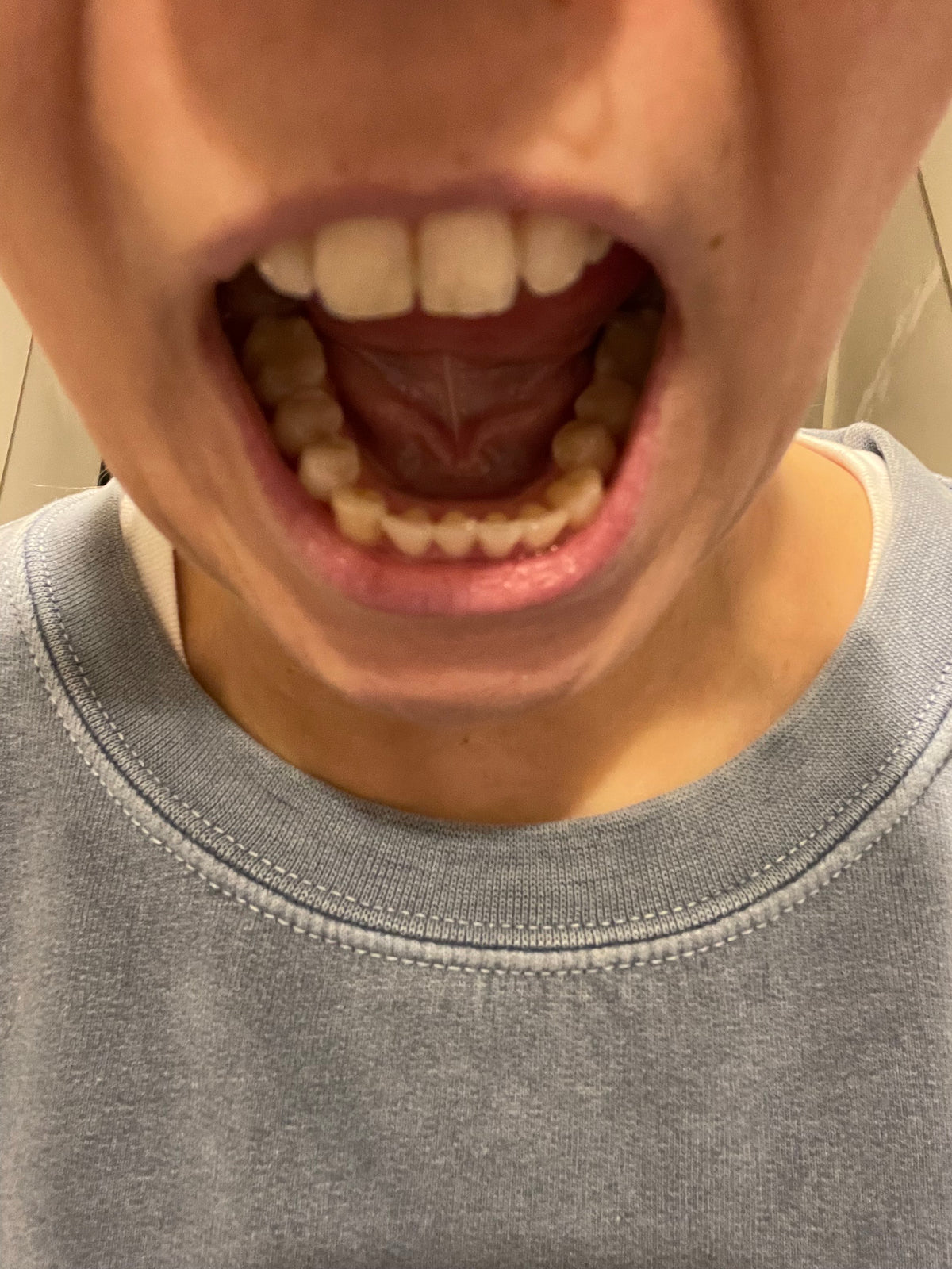 After treatment