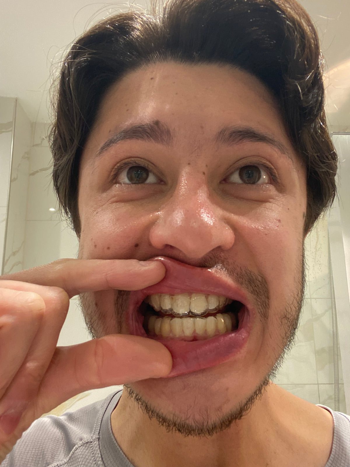 After treatment