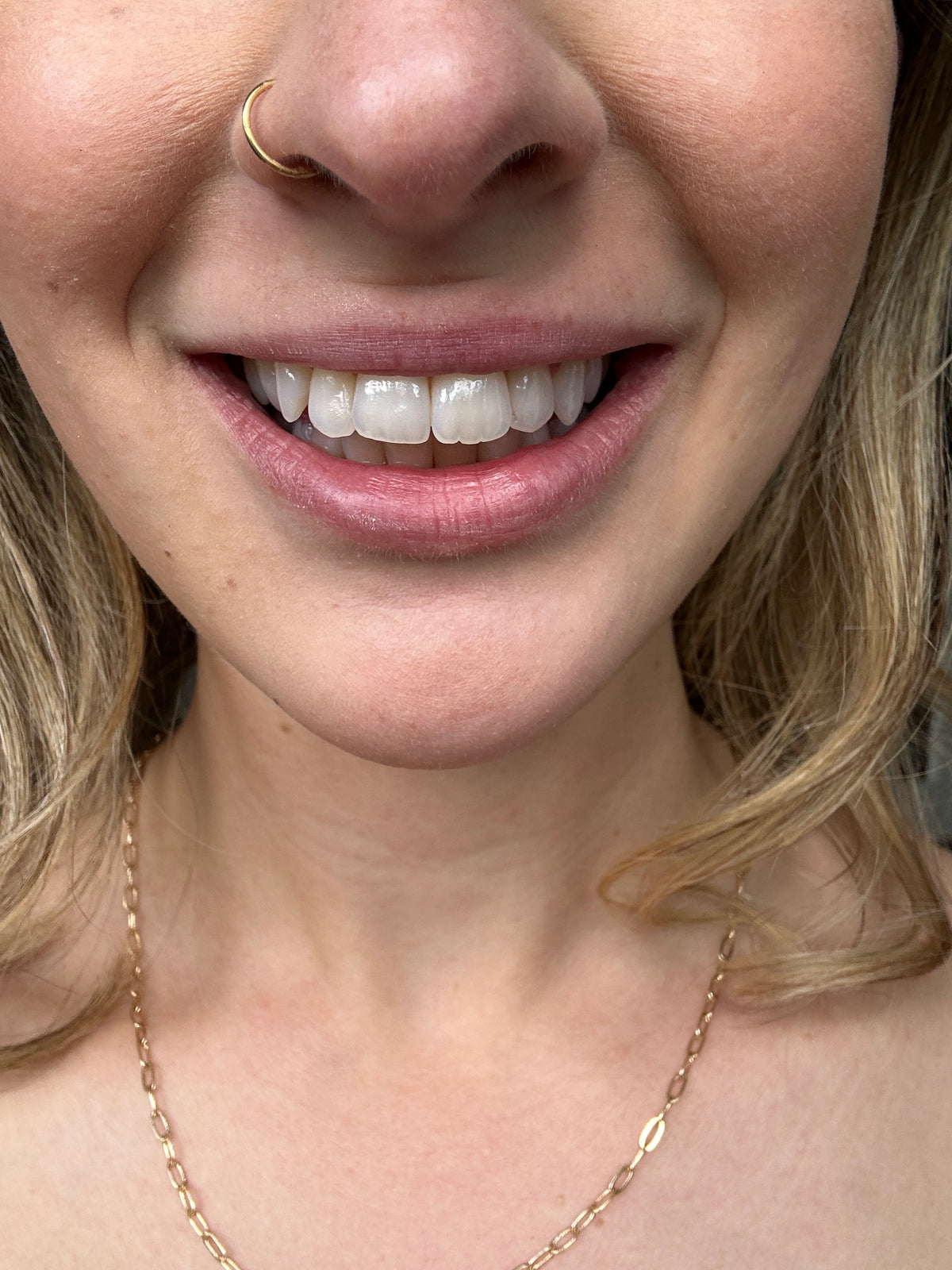 Before treatment