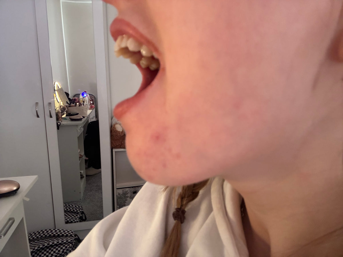 After treatment