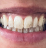 The results are amazing!