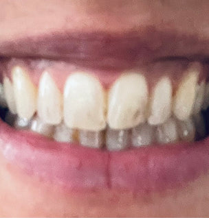 The results are amazing!