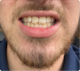 Really happy with the results!