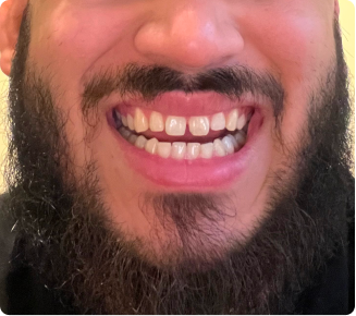 I love my new smile!
