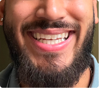 I love my new smile!