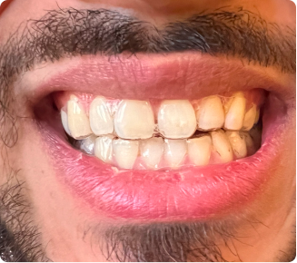 I love my new smile!