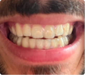 I love my new smile!